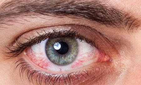 خطر ویروس کرونا برای چشم‌ها چیست؟