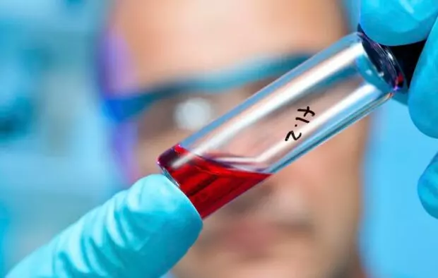 نتایج الهام بخش رویکردهای جدید درمانی کووید۱۹ با سلول درمانی