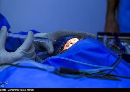 انجام عمل تغییر رنگ چشم ممنوع است/ عوارض خطرناک تتوی قرنیه چیست؟