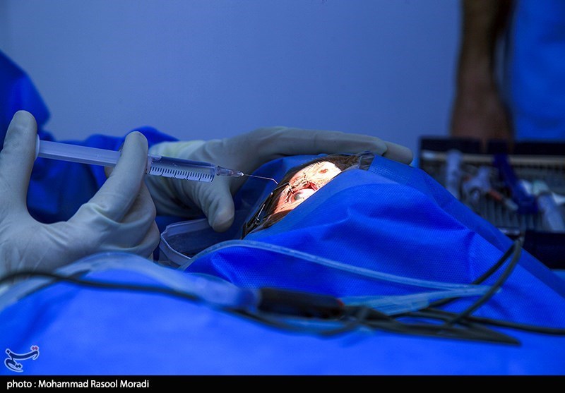 انجام عمل تغییر رنگ چشم ممنوع است/ عوارض خطرناک تتوی قرنیه چیست؟