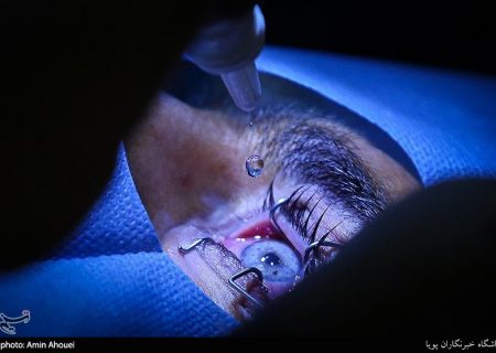 ردپای یک پزشک و مقام سابق مشهور در انجام جراحی ممنوعه/ اعزام بیماران از ایران به عمان برای تغییر رنگ چشم