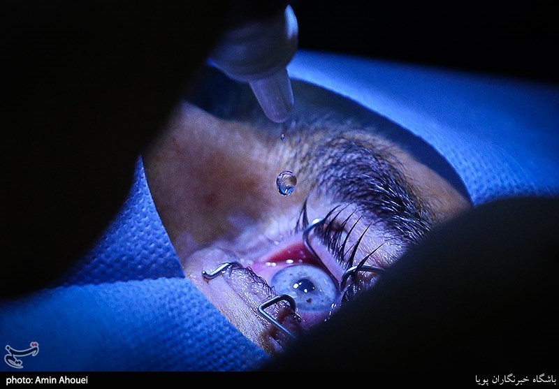 ردپای یک پزشک و مقام سابق مشهور در انجام جراحی ممنوعه/ اعزام بیماران از ایران به عمان برای تغییر رنگ چشم